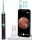 Homeistic Applience Earocam Earwax
